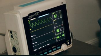 Electrocardiaogramme - Marie Duval sophrologue